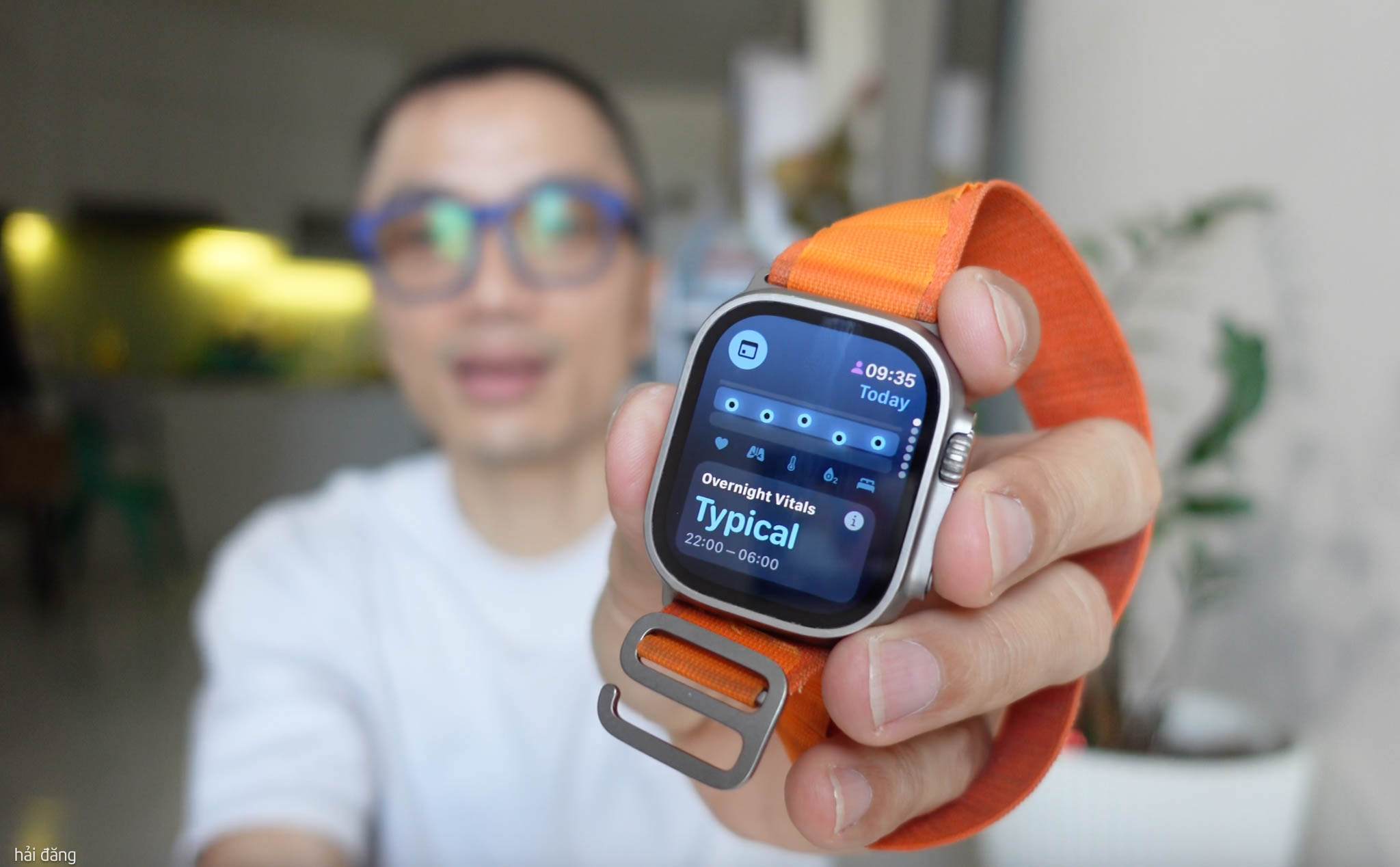Dùng thử watchOS 11 Beta Dev: Apple “vay mượn” tính năng hãng khác, nhưng làm dễ hiểu hơn